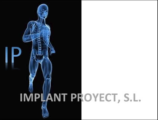 IMPLANT PROYECT